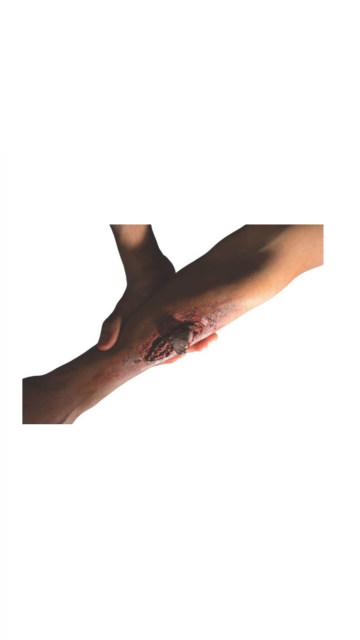 Broken Bone Prosthetic Effect